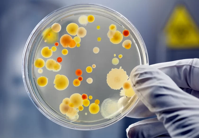 Bacterias en la orina