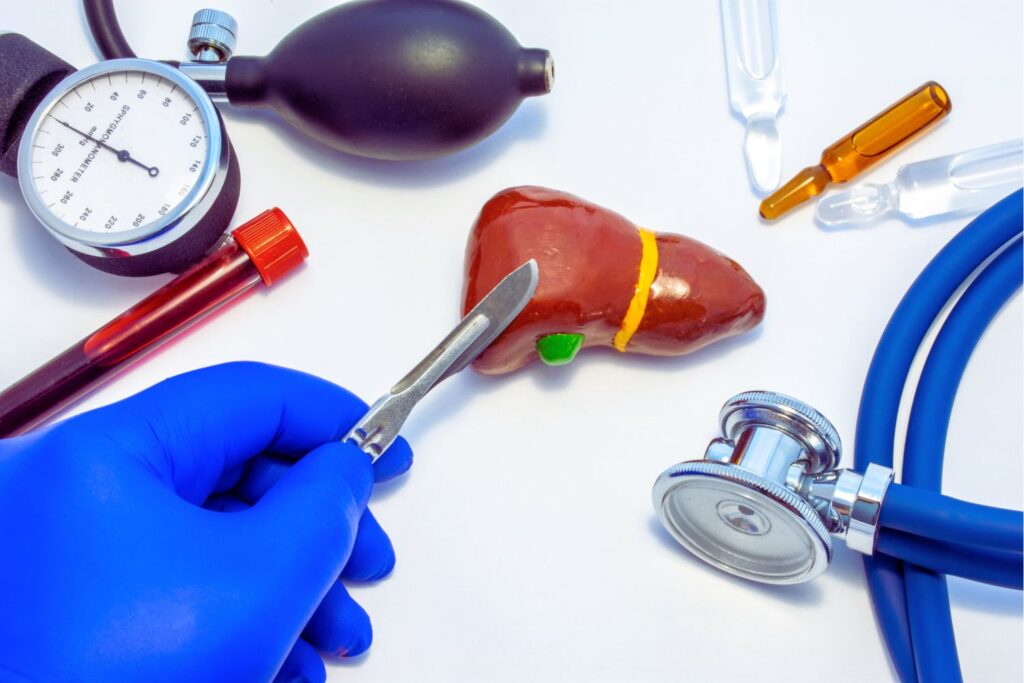 hepatectomía
