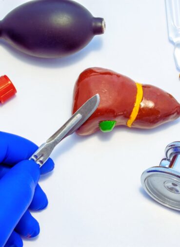 hepatectomía