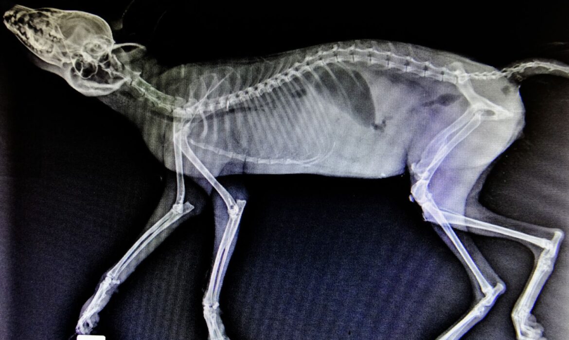 los tipos de fracturas