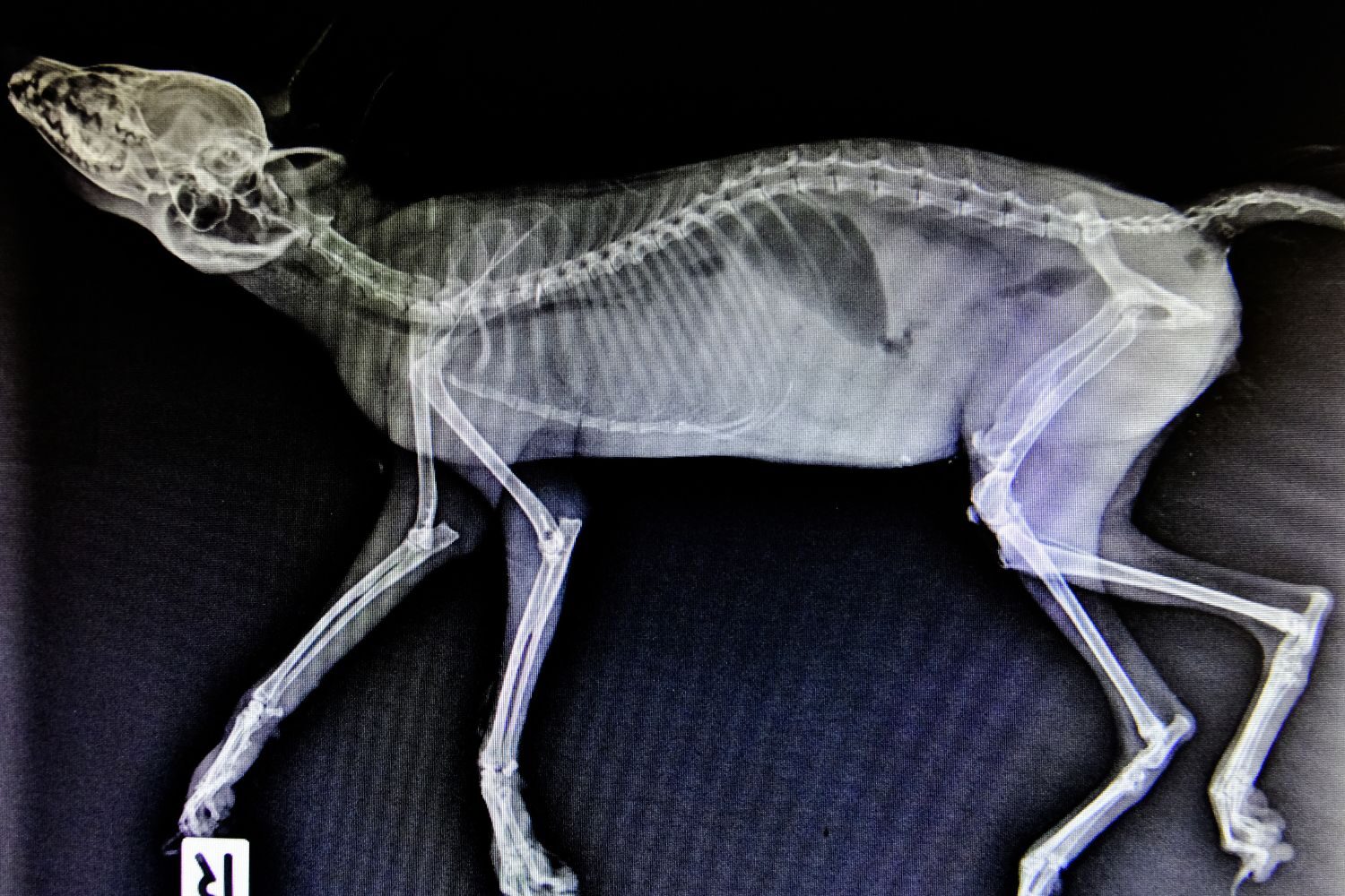 los tipos de fracturas