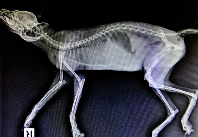 los tipos de fracturas